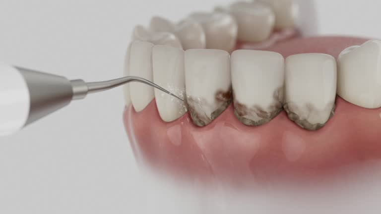 Trusted Dental Implants service in Lyman, MS - Dentist Open Now